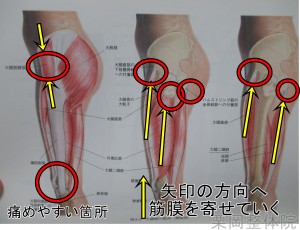 股関節の筋膜リリース