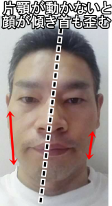 顎から顔の傾き首の歪みが生じる
