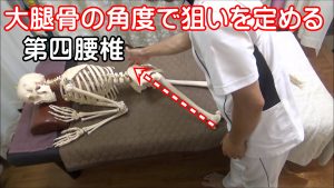大腿骨の角度で腰椎の狙いを定める
